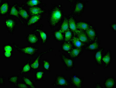 MMP11 Antibody