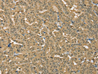 PSMC1 Antibody