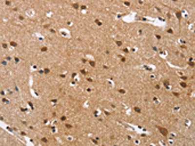 CACNA1D Antibody