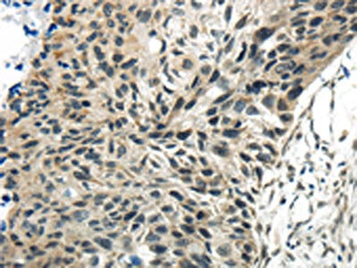 SYNCRIP Antibody