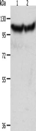 ACTN3 Antibody