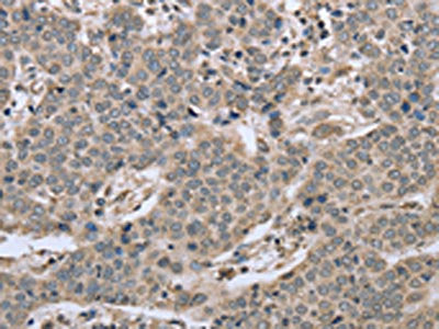 RHEB Antibody