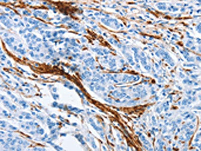 ACTA2 Antibody