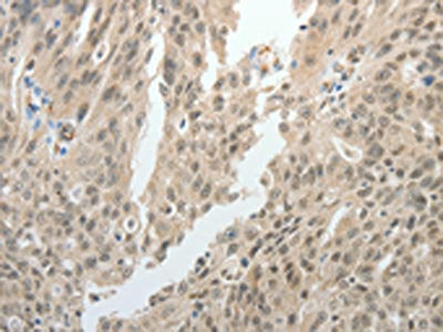 TOP1MT Antibody