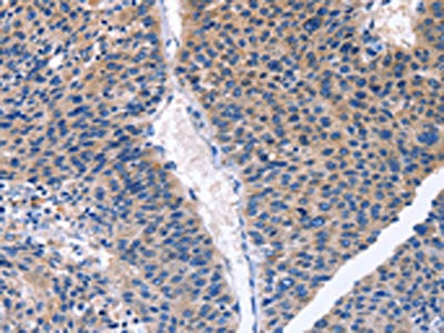 CDK2 Antibody