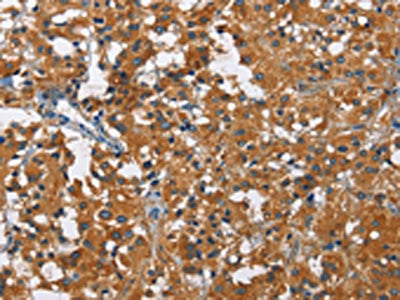 KLF7 Antibody