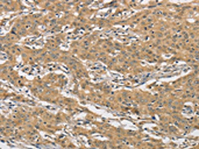 AMZ2 Antibody
