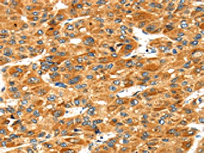 STXBP4 Antibody