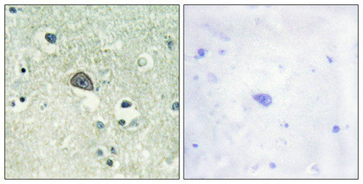 Phospho-GRIN1 (Ser890) Antibody