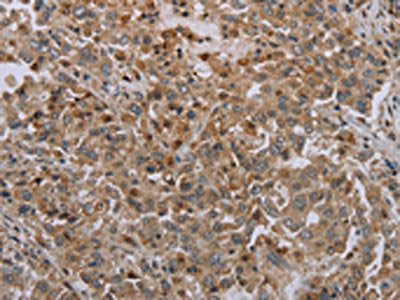 ERRFI1 Antibody