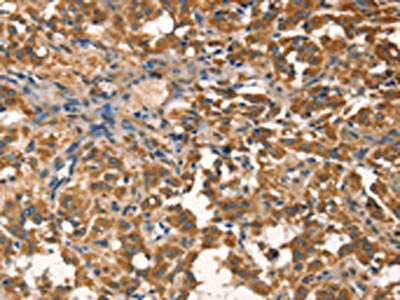 AGO1 Antibody