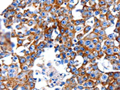 CLEC7A Antibody