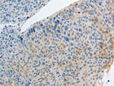 IL27 Antibody