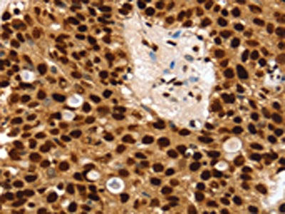 SSB Antibody