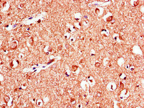 KL Antibody