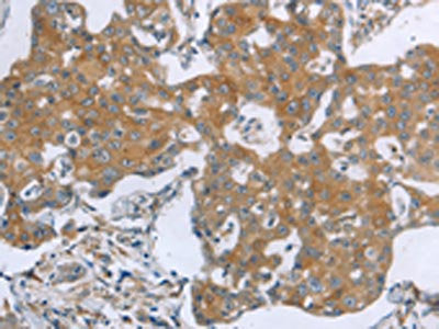TNK2 Antibody