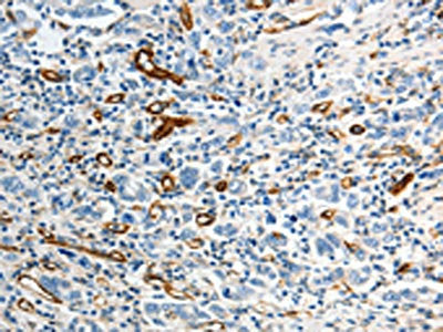 ABCG1 Antibody