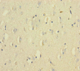 VWF Antibody