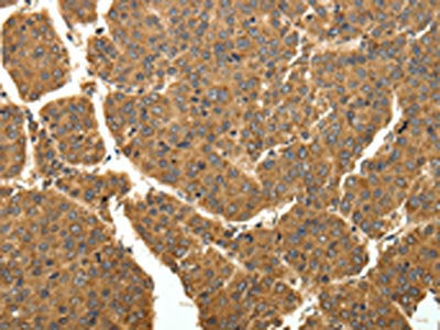COQ3 Antibody
