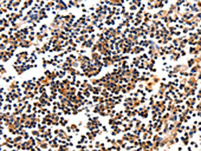 CAMK1 Antibody