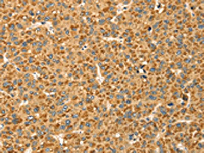 CAPN7 Antibody