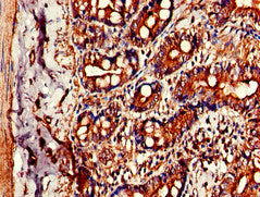 CIDEB Antibody
