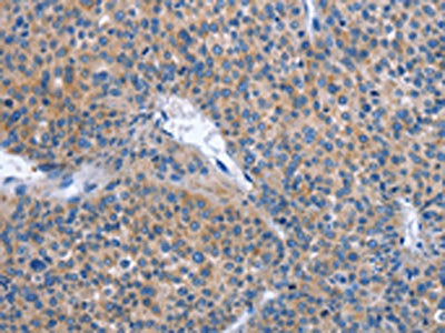 IBSP Antibody