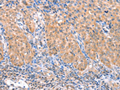 ACADS Antibody