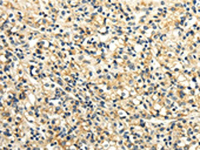 SLC6A19 Antibody