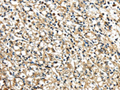 NME2 Antibody