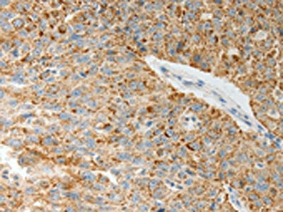 COL4A3 Antibody