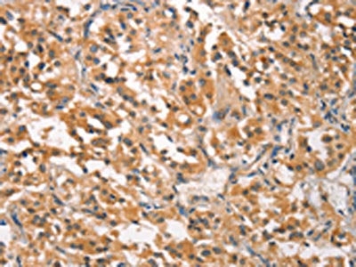 CRKL Antibody