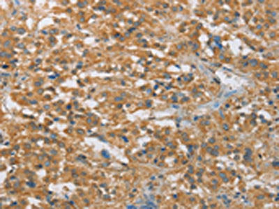 FASLG Antibody
