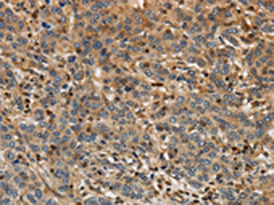 ARF6 Antibody