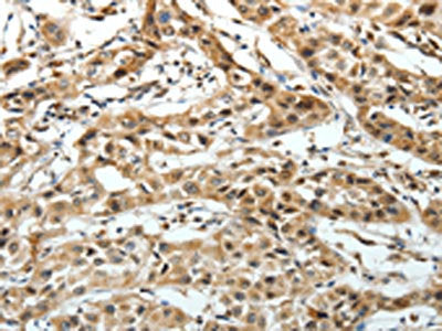 FZD3 Antibody