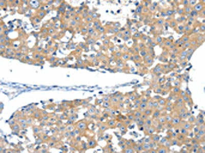 SSTR3 Antibody