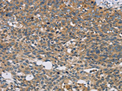 STAT4 Antibody