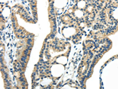 IL20 Antibody