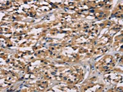 CGA Antibody