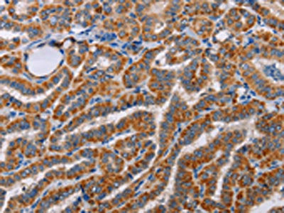ALG9 Antibody