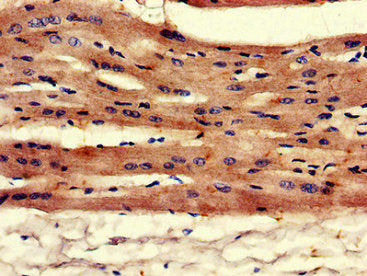 DES Antibody