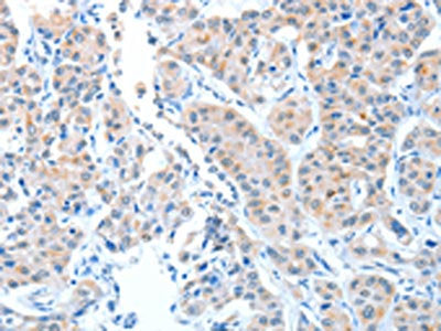 ADAMTSL1 Antibody
