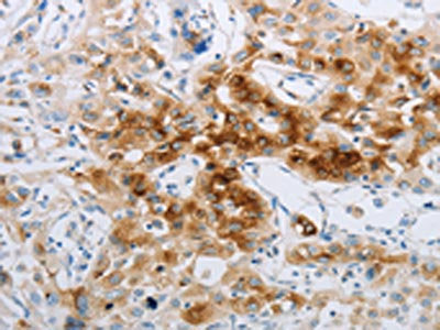 NPY2R Antibody