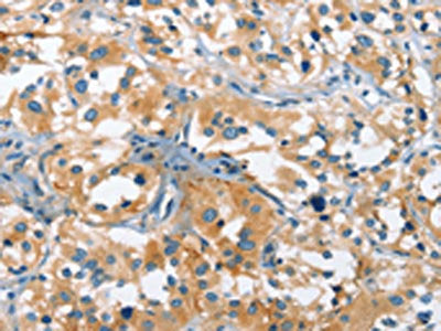 CACNA1C Antibody