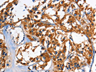 HK2 Antibody