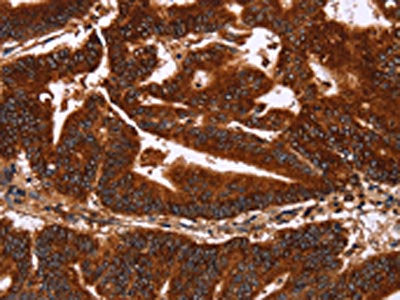 GCKR Antibody