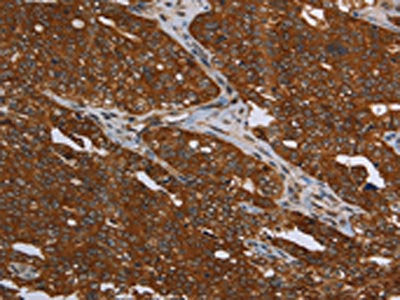 MCHR1 Antibody
