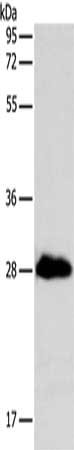 TNNI3 Antibody