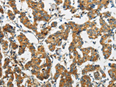 FABP2 Antibody