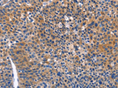ARRB1 Antibody
